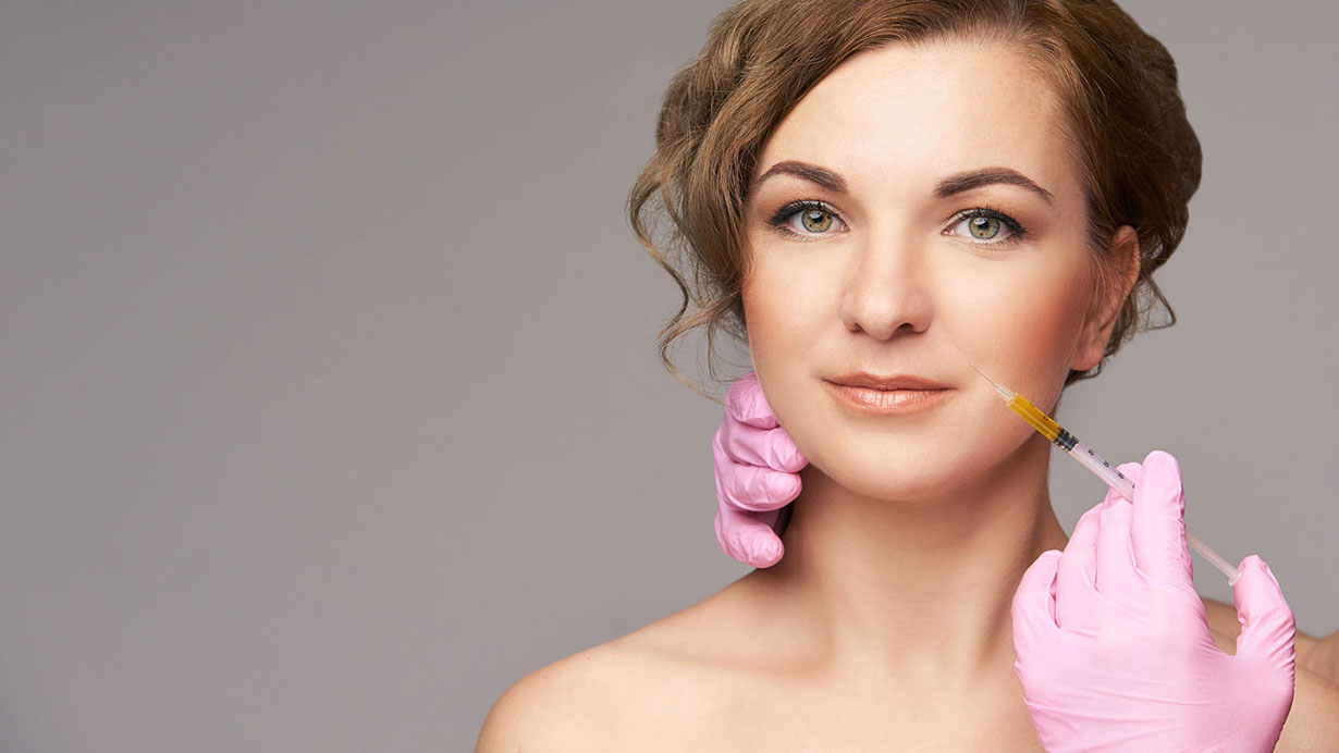 Juvederm_Vollure_Nasolabial