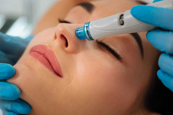 Microneedling_Nose-600×400